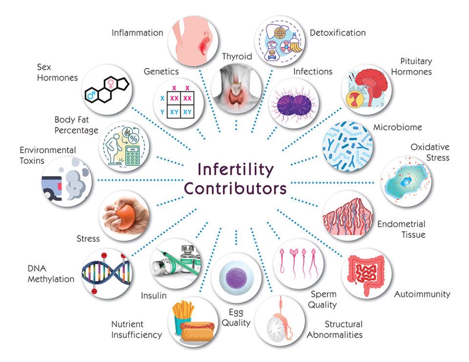 Chart showing factors that contribute to infertility, used in fertility treatments in San Diego