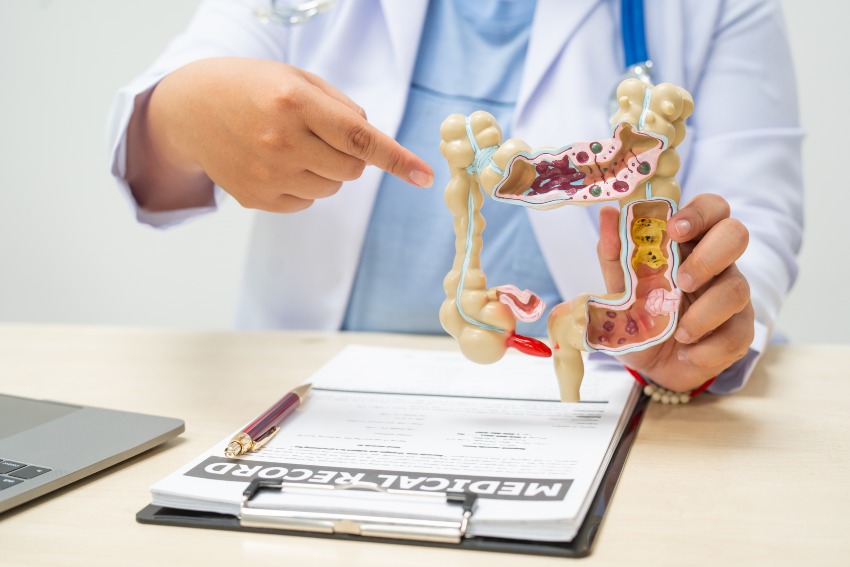 A doctor points at a human body model illustrating constipation in San Diego, CA