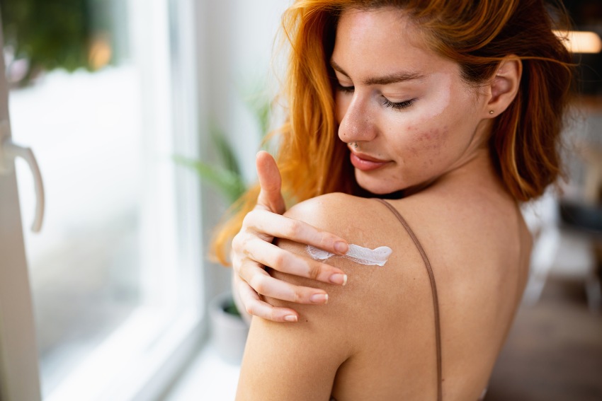 A woman with skin issues illustrating the fight against autoimmune disease in San Diego, CA