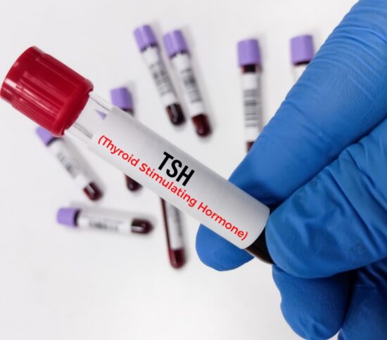 TSH blood test for thyroid evaluation at Advanced Functional Medicine in San Diego, CA